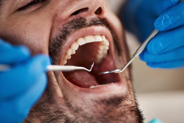 Best Emergency Dentist for Knocked-Out Tooth in Patchogue, NY